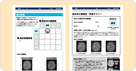 認知症リスクチェック